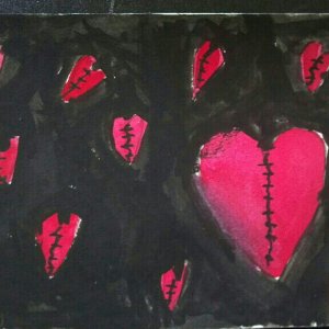 Scars
