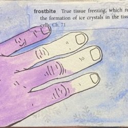 Frostbite.jpeg