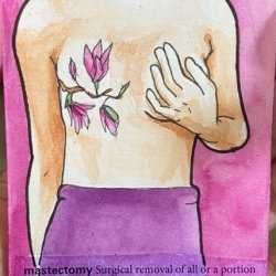 Mastectomy.jpeg