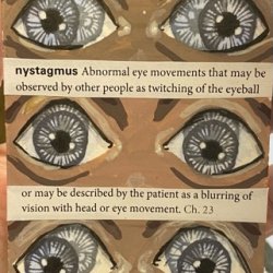 Nystagmus.jpeg