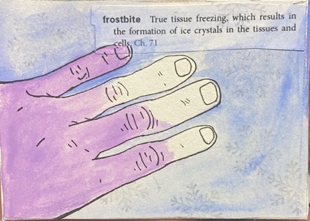Frostbite.jpeg
